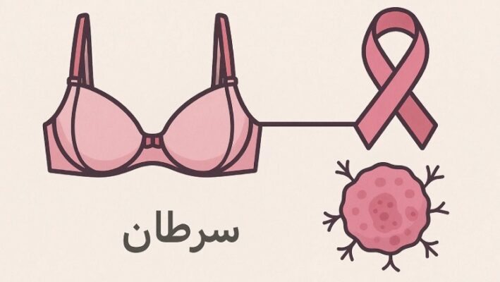آیا بستن سوتین باعث سرطان سینه می‌شود؟
