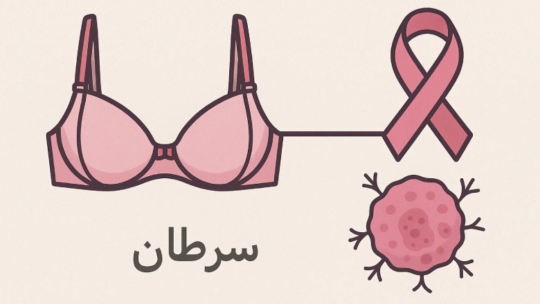 آیا بستن سوتین باعث سرطان سینه می‌شود؟